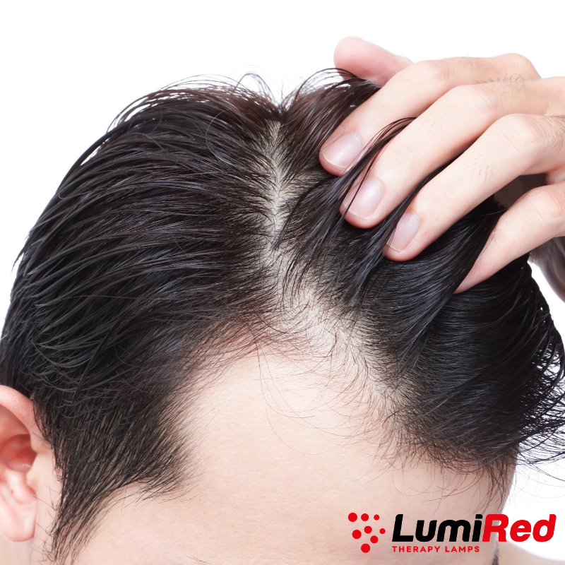 red light therapy for hair growth